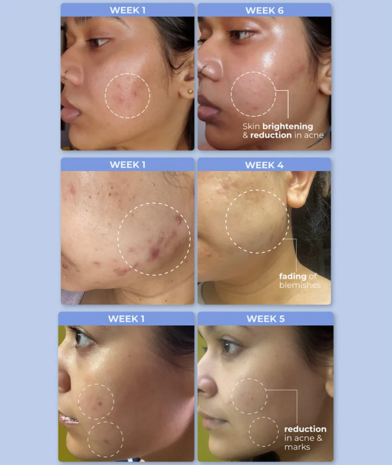 All-In-One Serum - Hustle