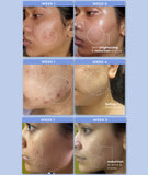 All-In-One Serum - Hustle