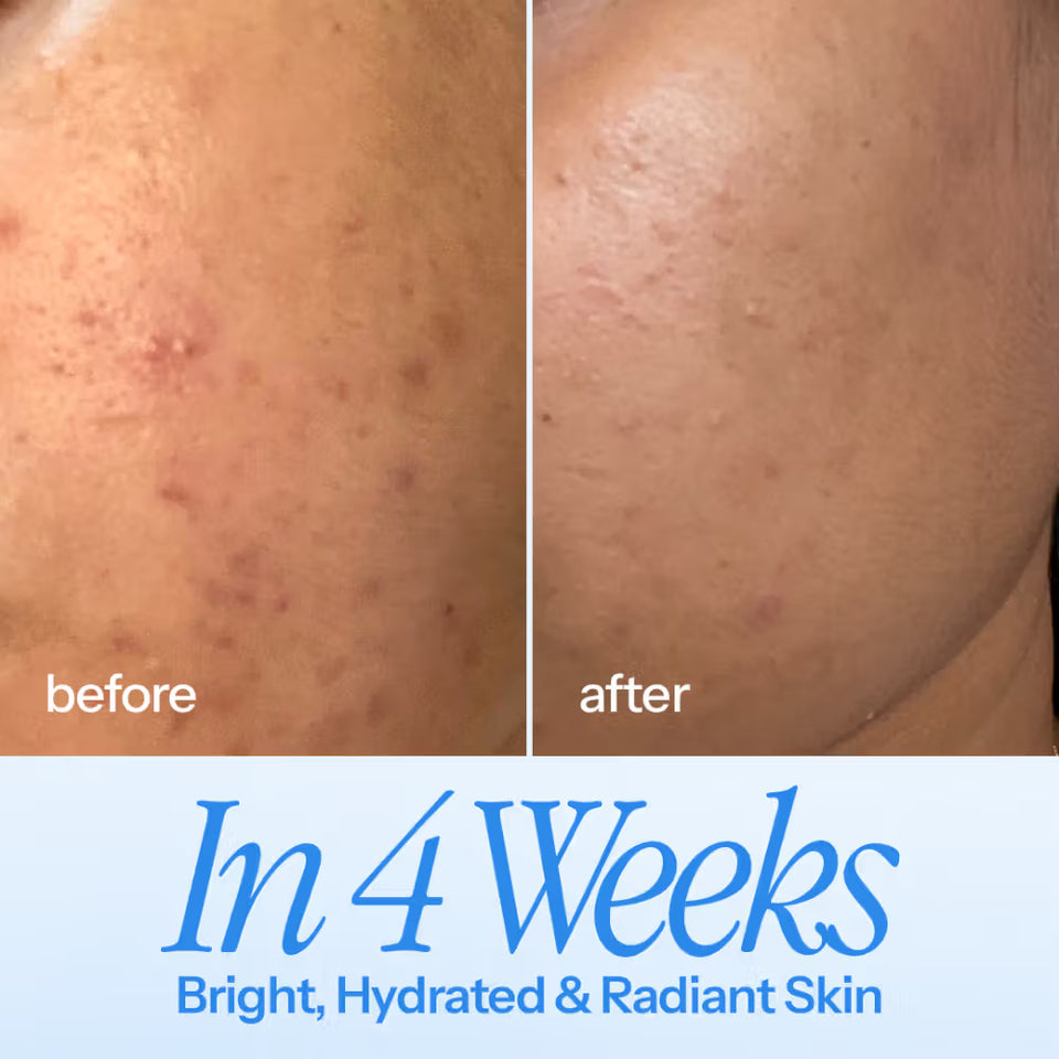 All-In-One Serum - Hustle